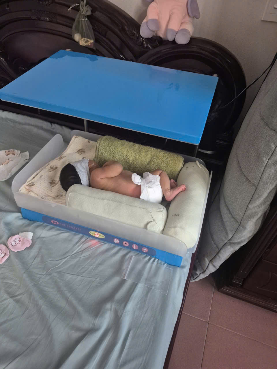Bé sơ sinh nằm trong nôi đèn chiếu vàng da tại nhà